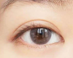 西安双眼皮修复医生排行哪个最厉害？西安双眼皮修复预约最多的专家排名