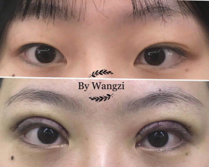 上海九院双眼皮修复专家是谁？上海修复双眼皮医生预约排行榜
