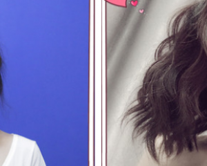 上海九院哪个医生做自体脂肪面部填充好？曹卫刚、魏皎、谢峰、张路谁更好？