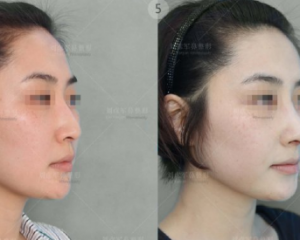 中国最好的鼻子修复整形医生预约排行榜