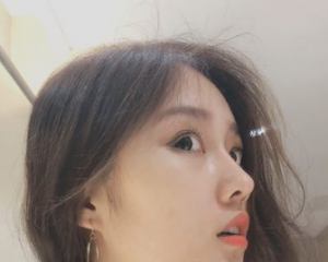 成都黄开亮鼻子做得好吗？成都黄开亮隆鼻简介预约