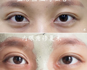 广州最擅长做眼部修复的医生排名有哪些？阮庆玲、潘贰、张克、李光琴、马松哲谁更好？