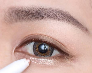 张冰洁和田国静卧蚕修复哪个好?田国静张冰洁做卧蚕修复谁最好?