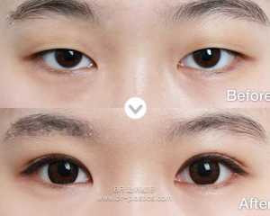 中国眼部最权威的整形医生有哪些？