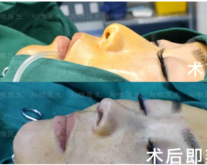 北京八大处隆鼻修复哪个比较好？范飞、刘暾、王克明、王欢、尤建军谁做鼻修复技术厉害？