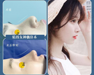 重庆做鼻子最有名的医生是哪个？重庆做鼻子最有名的专家预约排行榜