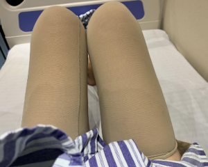 北京大腿吸脂好的医生权威专家推荐 北京大腿吸脂好的医生预约排行榜大全