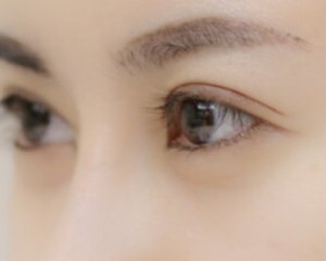 上海九院做双眼皮哪个专家最好？上海九院双眼皮医生预约排行榜
