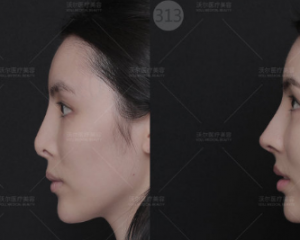 北京有没有靠谱的鼻子整容的医生预约排名