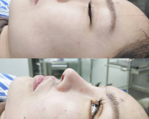 中国鼻部整形专家排名前十 中国鼻部整形医生预约排名前十名