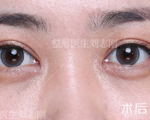 国内修复双眼皮权威专家排名 国内双眼皮修复权威医生排行榜