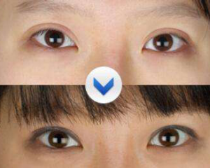 上海九院双眼皮修复医生推荐 上海九院双眼皮修复专家预约排名排行榜