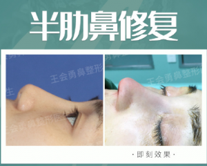 上海最好的鼻子修复医生有哪些？上海最好的鼻子修复专家预约排行榜大全
